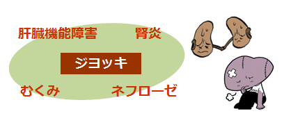 ジョッキの説明画像