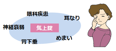 気上錠の説明画像